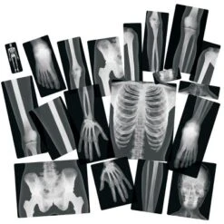 Royclo Human X-Rays On Film - 18 Pieces